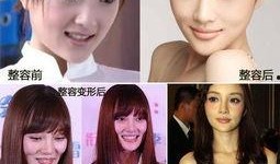 西安整容爆料事件视频,揭秘美容行业潜规则与真实案例