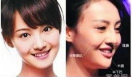 西安整容爆料事件视频,揭秘美容行业潜规则与真实案例