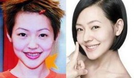 整容男网红吃瓜事件真相