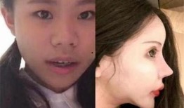 整容男网红吃瓜事件真相